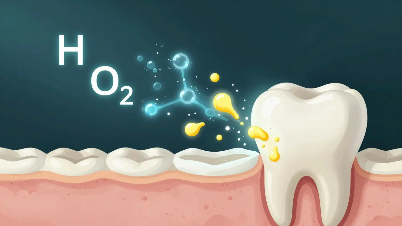 Chemická reakce peroxidu vodíku vnitřně bělí zubní sklovinu.