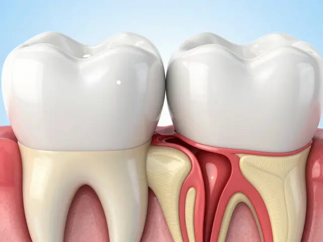 Jak se zbavit zubního kazu a jak mu předcházet: Kompletní průvodce