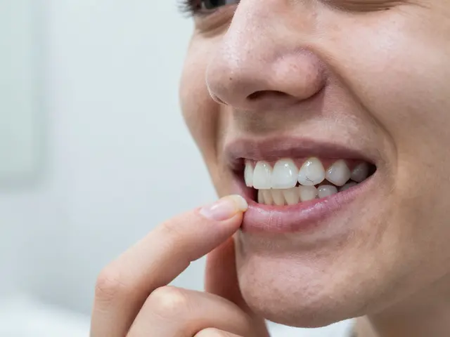 Fazety na křivé zuby: Jak se o ně starat, aby vydržely